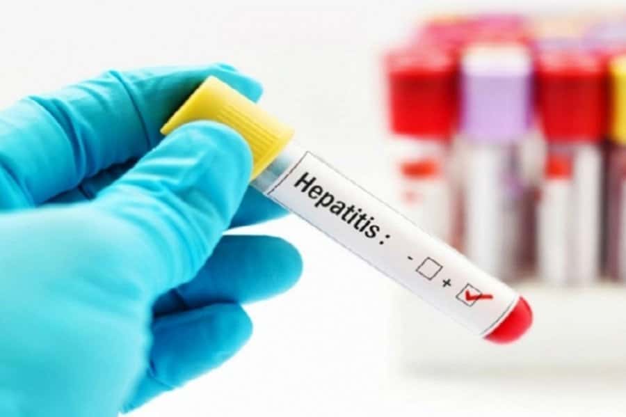 Invitan a los vecinos a realizarse el test de detección de hepatitis