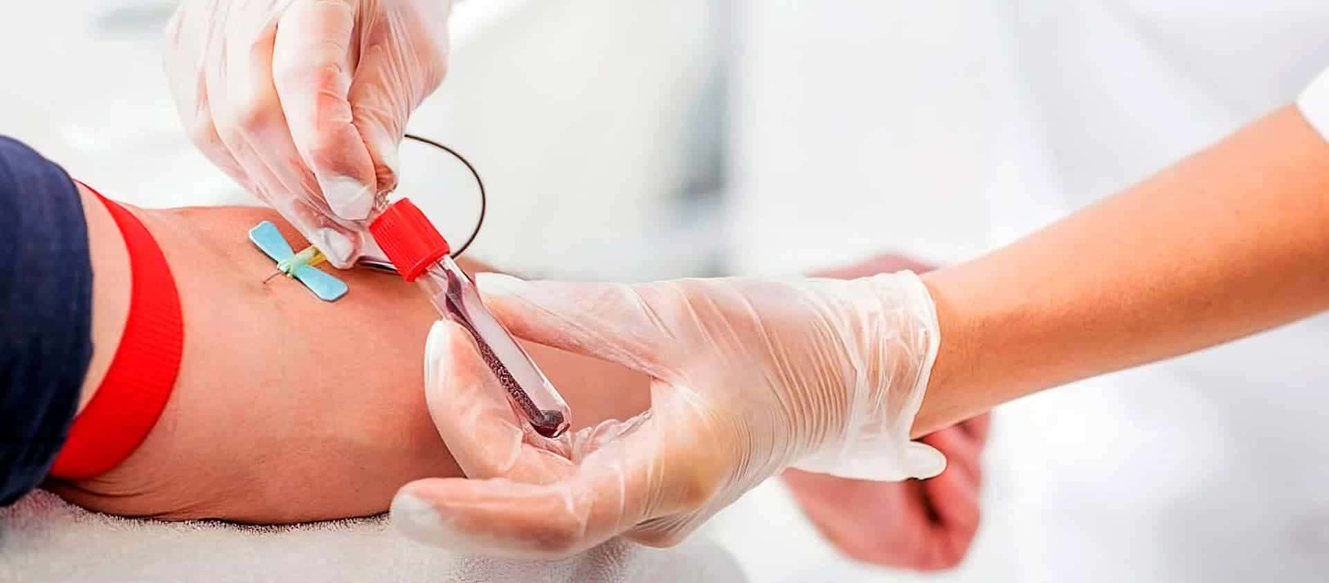 HRRG: Se necesita con urgencia donantes del grupo 0 (-)