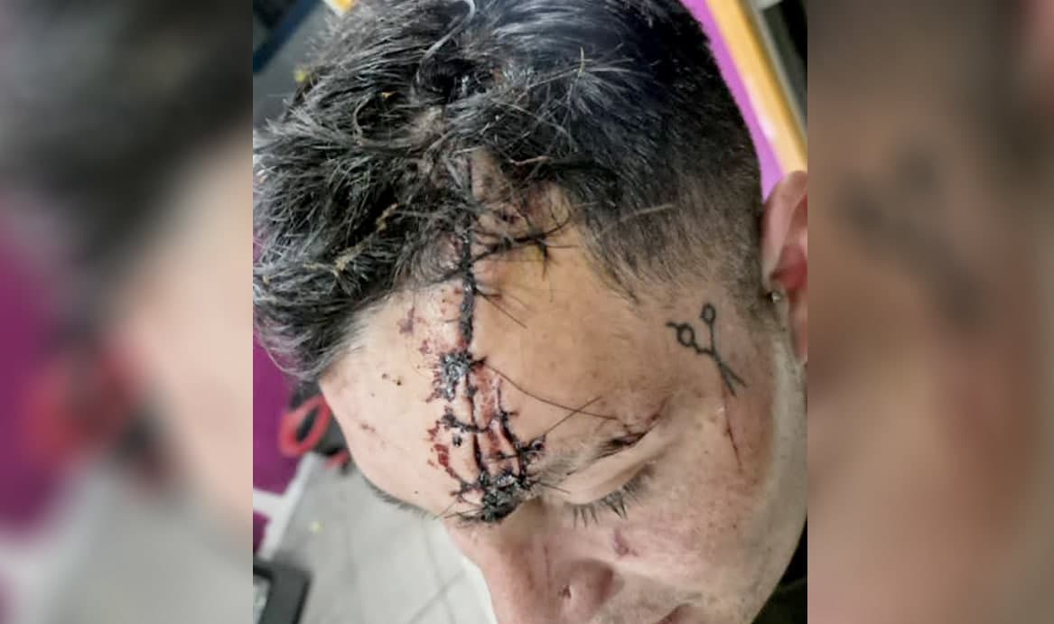 Investigan ataque a un hombre y abren causa por estupefacientes