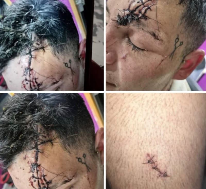Brutal ataque en Ushuaia: un joven terminó con 90 puntos