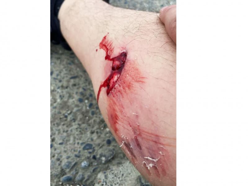 Grave ataque de un pitbull a un adolescente en Chacra XI