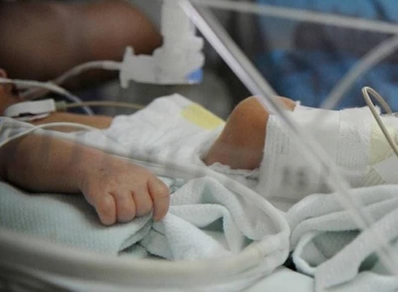 Mejora el estado de salud del bebé internado con quemaduras